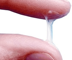 როგორ გამოიყურება მამაკაცის სეკრეცია ჩვეულებრივ